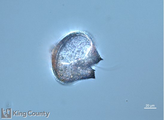 Photo of Protoperidinium conicum/Protoperidinium leonis